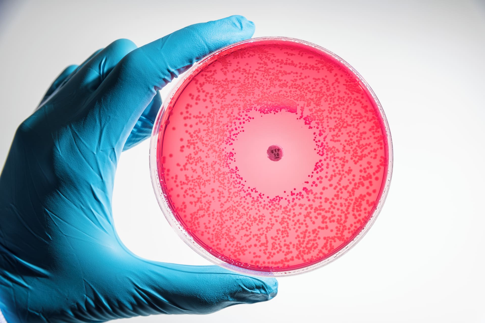 A gloved hand holds a petri dish full of tiny dots in the red solution.