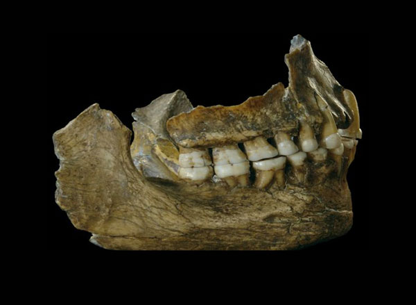Neandertal teeth