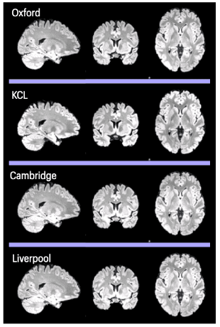 T2 Flair Images taken from the Travelling Heads proforma publication