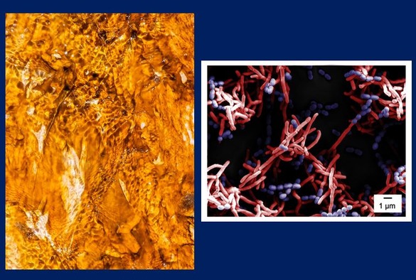 Left- 1st place “Biofilm River” by Jontana Allkja. Right-2nd place “Connectivity and co-existence in mixed biofilm”