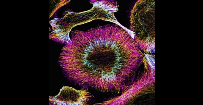 An image of cancer cells that have been labelled with components of the cytoskeleton.