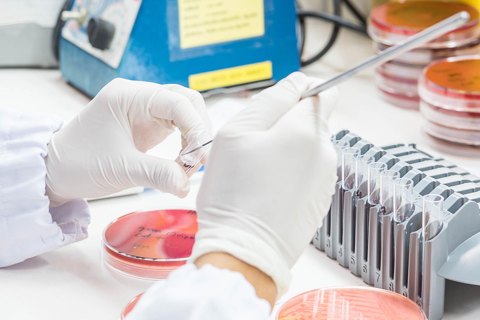 Close up on hand medical technicians working on bacterial culture and drug resistance of pathogens in laboratory