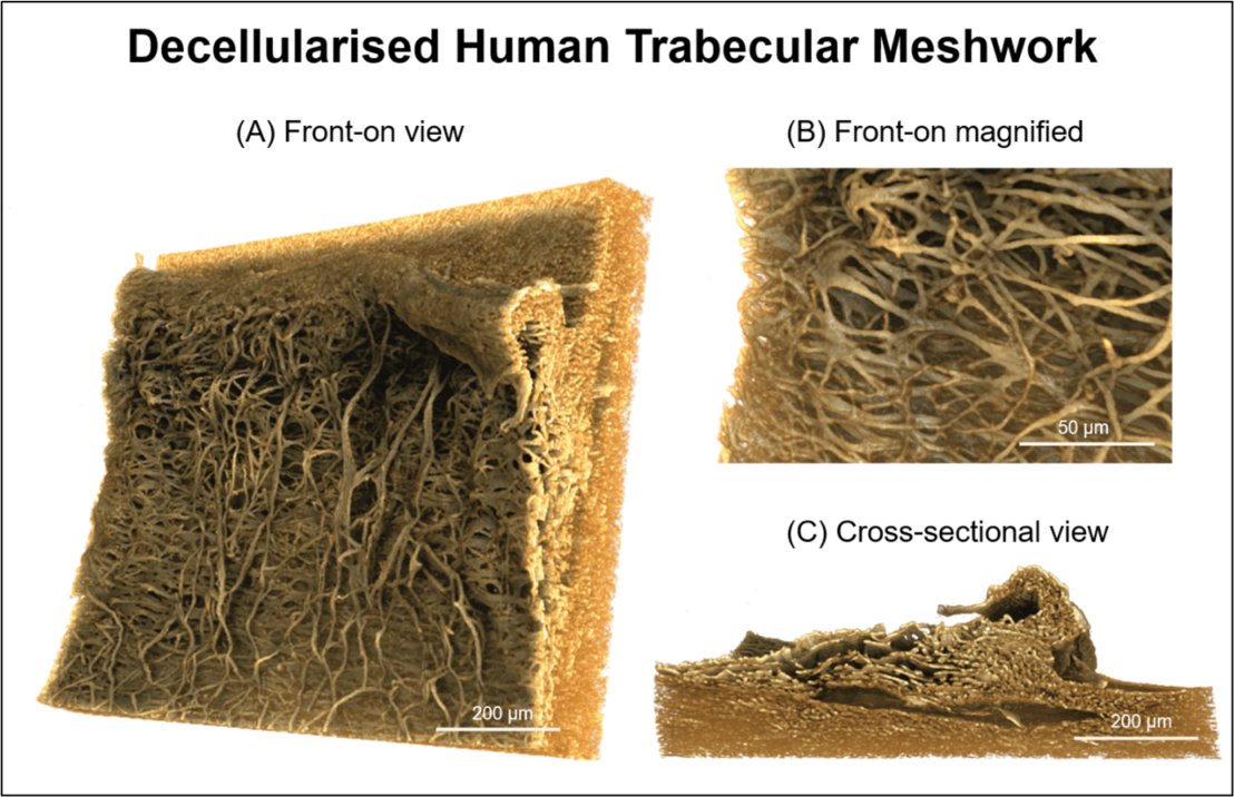Three volume renderings of trabecular mesh from an eye